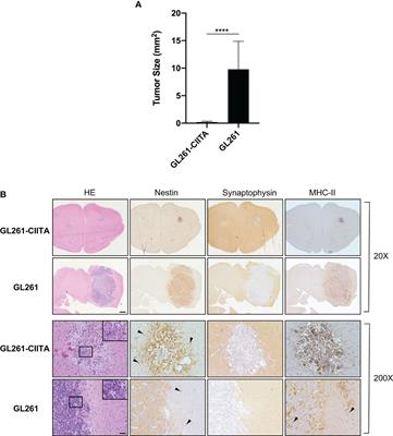 Frontiers | Protective anti-tumor vaccination against glioblastoma